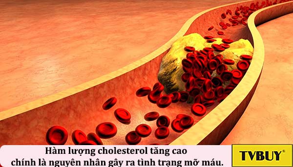 Hàm lượng cholesterol tăng cao chính là nguyên nhân gây ra tình trạng mỡ máu.